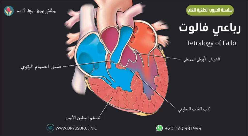 رباعي فالوت