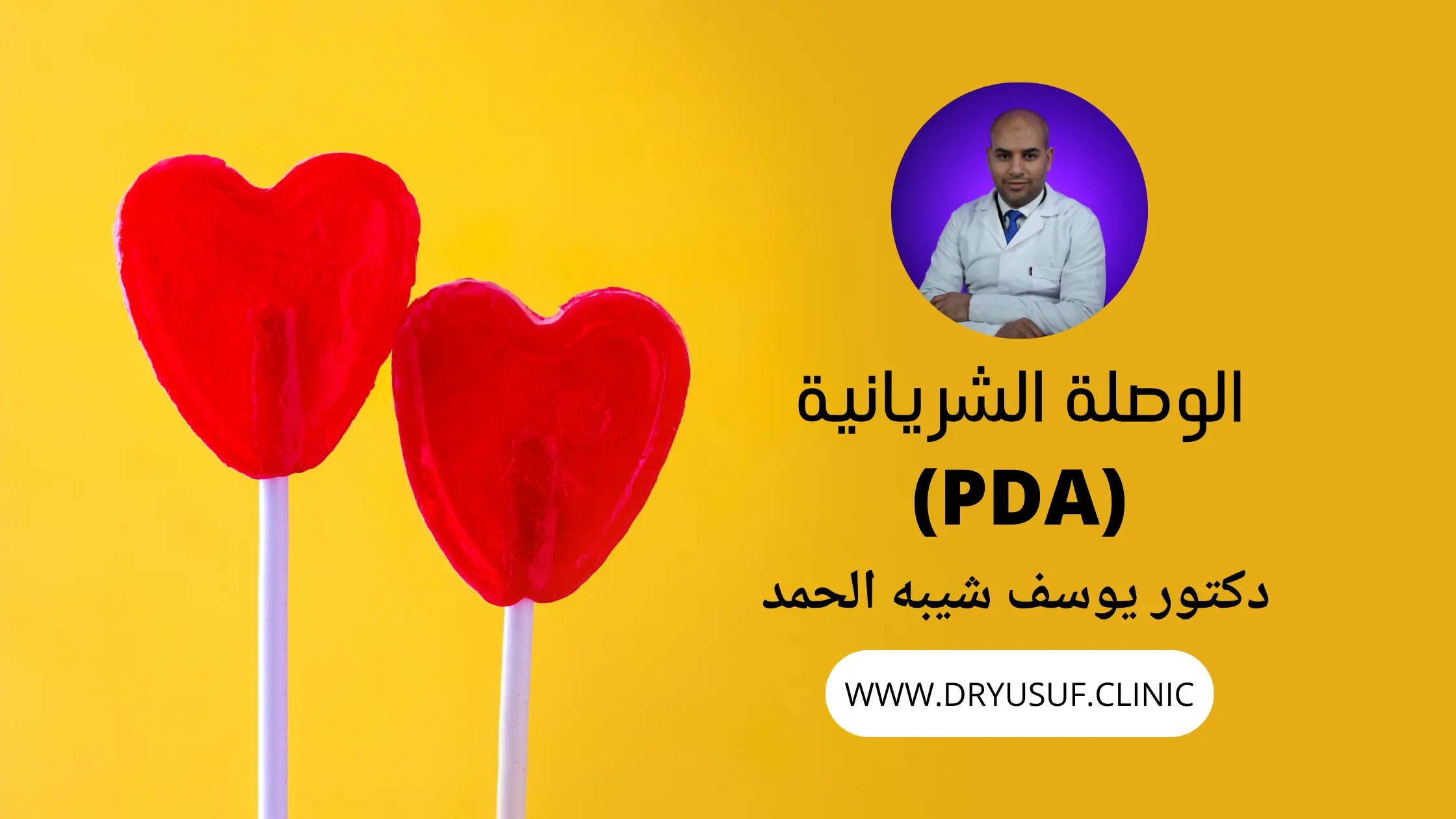الوصلة الشريانية المفتوحة