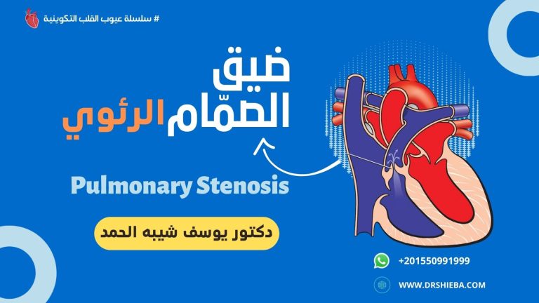 ضيق الصمام الرئوي عند الاطفال