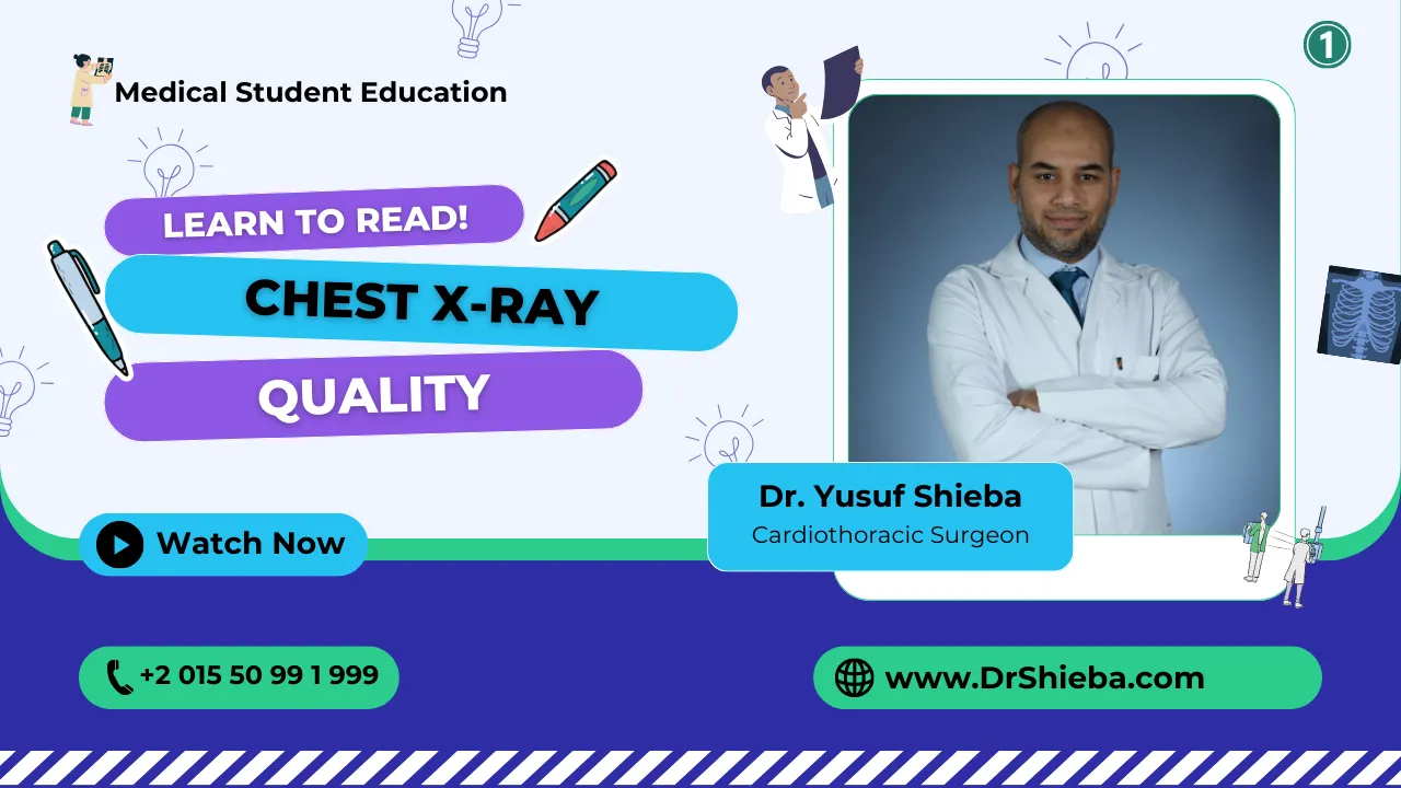 chest xray quality