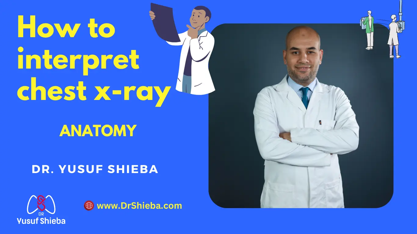 how to interpret chest xray anatomy